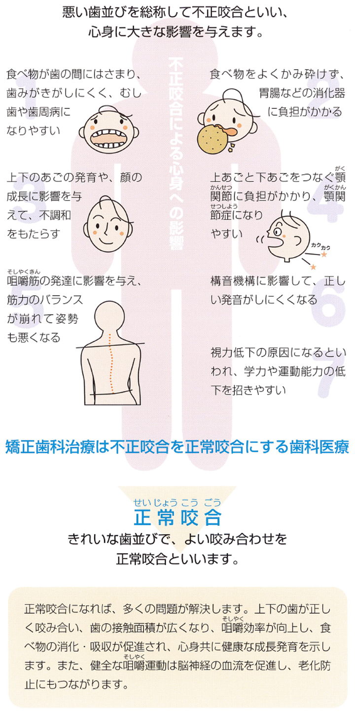 不正咬合について