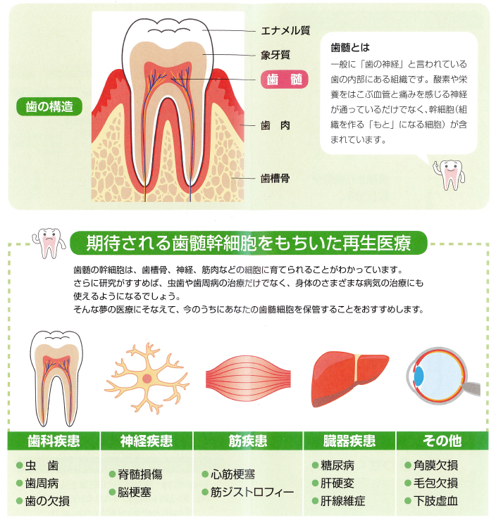 歯髄細胞バンク