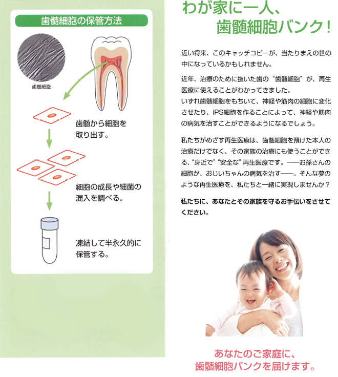 歯髄細胞バンク
